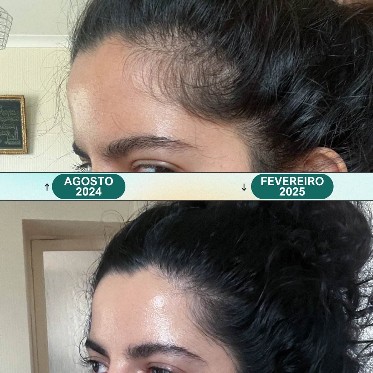 Massageador Elétrico De Corporal Cuidados Com A Saúde Relaxe Cabeça Couro Cabeludo Massagem Amassar Dispositivo Vibratório Renovati