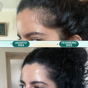 Massageador Elétrico De Corporal Cuidados Com A Saúde Relaxe Cabeça Couro Cabeludo Massagem Amassar Dispositivo Vibratório Renovati